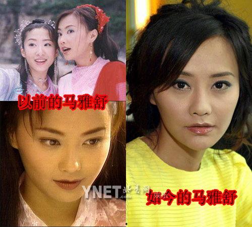 那些明星整容过,那些曾经整形变脸的明星大揭秘
